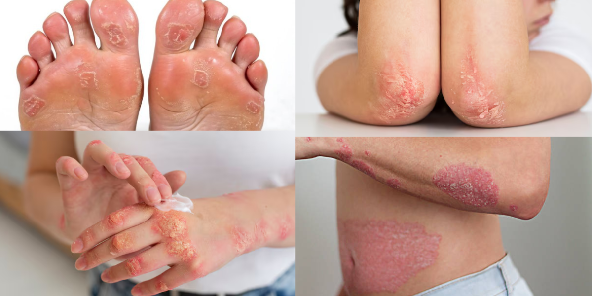 Dr. Mukesh Sharma Best Ayurvedic Wellness Center in Jaipur