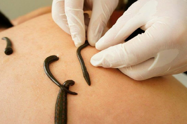 Dr. Mukesh Sharma Best Ayurvedic Wellness Center in Jaipur